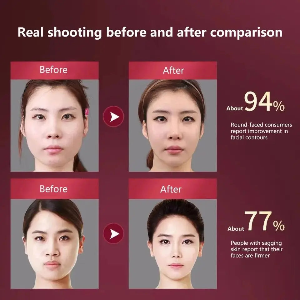 Facial Lifting Massager